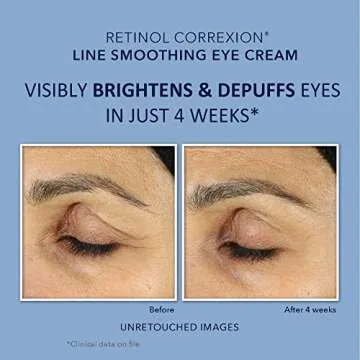 RoC Retinol Correxion Duo for Eye Care & Anti-Aging