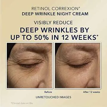 RoC Retinol Correxion Duo for Eye Care & Anti-Aging