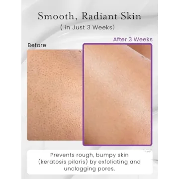 Elvira KP Bump Eraser Scrub for Smooth Skin Care