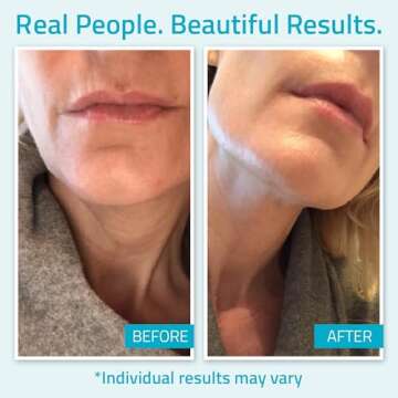 YEOUTH Day Night Cream for Face with Hyaluronic Acid, Snail Mucin and Copper Tripeptide,Hydrating Moisturizer Face Cream for Women and Men 4oz