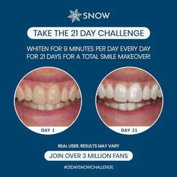 SNOW Diamond Wired Whitening Kit - Sensitive Teeth Whitening Kit - Whitens & Repairs Teeth 6 Months of Treatment Gentle & Enamel Safe Blue