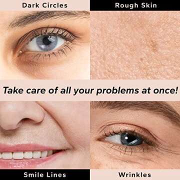 misoli Retinol & Collagen Under Eye Patches - Under Eye Patch for Puffy Eyes & Bags, Dark Circles and Puffiness, Cooling Patches for Skincare, Under Eye Patchess for Beauty & Personal Care