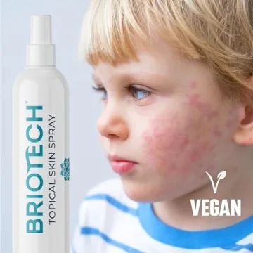 Briotech Hypochlorous Acid Spray - Soothing Skin Relief