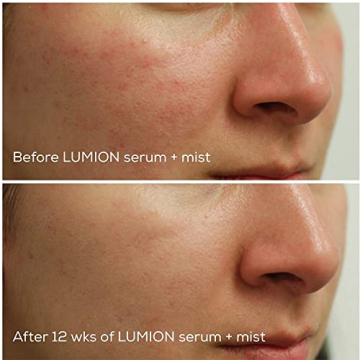 Lumion Skin Miracle Mist | Hydrate & Soothe Skin on-the-go