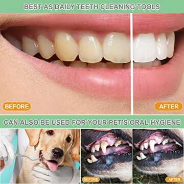 Professional Dental Tools Set - Effective Teeth Cleaning Kit