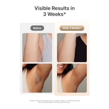 Ulike Laser Hair Removal for Women and Men, Air 3 Ice-Cooling IPL Hair Removal Device for Nearly Painless & Long-Lasting Results, 3 Modes & Auto Flashing for Fast Full Body Hair Removal from Home