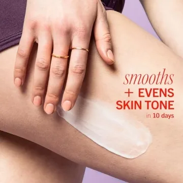 First Aid Beauty KP Body Lotion with 10% AHA Exfoliation