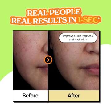 vividraw Baobab Hydrogel to Drop Ampoule | Hydrating & Redness Reducing Face Serum with Hyaluronic A...