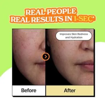 vividraw Baobab Hydrogel to Drop Ampoule | Hydrating & Redness Reducing Face Serum with Hyaluronic A...