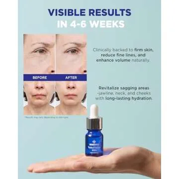 100% Volufiline Serum Skincare – Advanced Firming & Lifting Facial Ampoule from France Sederma, Intense Hydration & Skin Rejuvenation for Youthful, Perfect for Layering & DIY, 0.33 fl.oz (10ml)