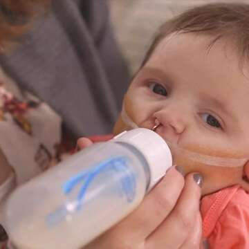 Dr. Brown's Medical Specialty Feeding System, Narrow Baby Bottle, Infant-Paced Feeding Valve, Oral Feeding Solution for Infants with Cleft Lip, Tongue Tie, Lip Tie, 8 oz/250 mL – 2-Pack