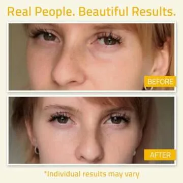 YEOUTH Under Eye Gel with Hyaluronic Acid for Puffiness, Under Eye Bags & Circles, Hydrating Skincare for Tired-Looking Eyes 1oz