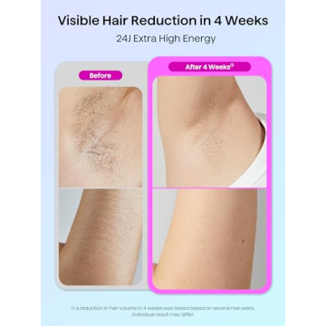 IPL Hair Removal Device with Ice Cooling for Painless Results