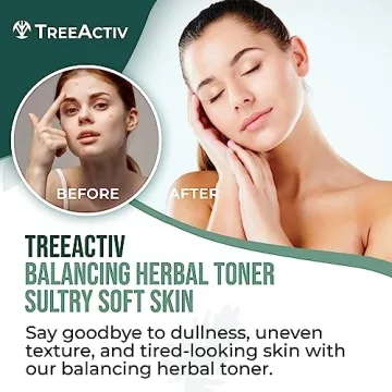TreeActiv Herbal Balancing Toner for Clear Skin - 4 oz