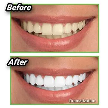 Ontel Natural Teeth Whitener - Safe Charcoal Powder