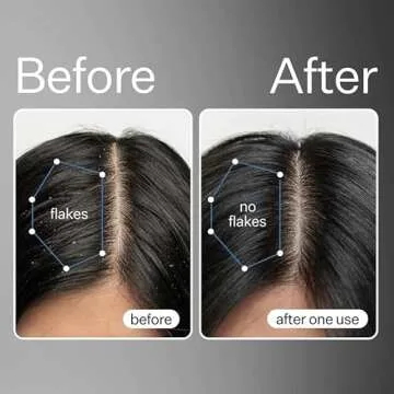 Act+Acre Cold Processed Stem Cell Scalp Serum and BHA Salicylic Acid Scalp Exfoliator Bundle - Promotes Thicker and Fuller-Looking Hair - Soothes and Hydrates - Dry Itchy Scalp - Dry Scalp -Oily Hair