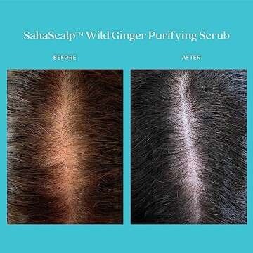 Fable & Mane SahaScalp Wild Ginger Purifying Scalp Scrub. Dry Scalp Treatment, Itchy Scalp Shampoo, Exfoliating Scalp Detox, Itchy Scalp Treatment - Genuine Fable and Mane Scalp Cleanser. 8FL oz