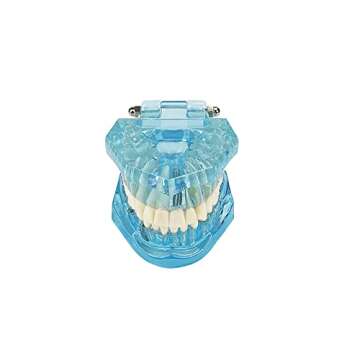 YOUYA DENTAL Transparent Dental Implant Teeth Model - Removable Transparent Pathological Model for D...