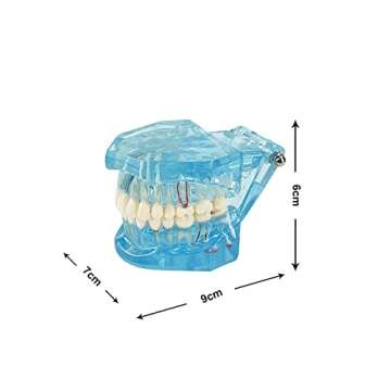 YOUYA Transparent Dental Implant Teeth Model for Dentists