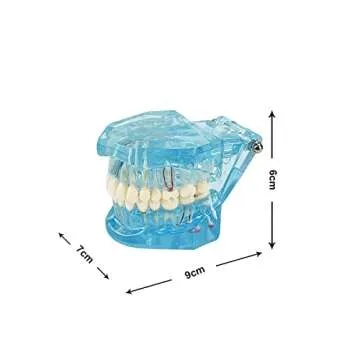 YOUYA Transparent Dental Implant Teeth Model for Dentists
