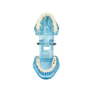 YOUYA Transparent Dental Implant Teeth Model for Dentists