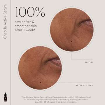 True Botanicals Chebula Active Serum | Optimizes Skins Collagen Levels | Anti-Aging Serum | Treats Fine Lines & Wrinkles | All Skin Types | Dermatologist Tested, All Natural, Vegan | 1 fl oz | 30 ml