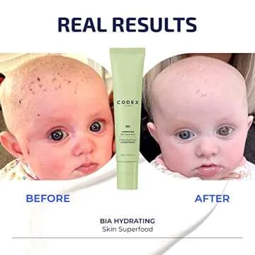 Codex Labs Hydrating Superfood Moisturizer - Body and Face Cream for Sensitive Skin for Women, Men and Kids - Steroid-Free, Vegan Moisturizer for Dry, Eczema-Prone Skin - 75ml