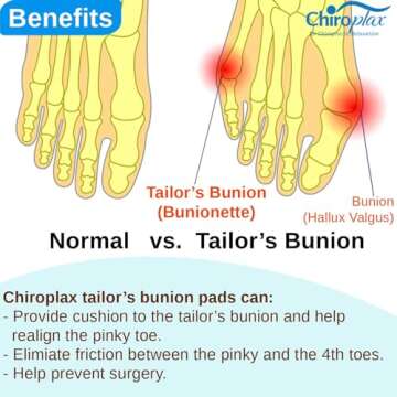 Chiroplax Tailor's Bunion Corrector Pads Bunionette Pain Relief Pinky Little Toe Straightener Separator Cushion Splint Protector Shield Spacer Cover Guard (4 Pads, Shims -Small)