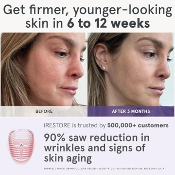 iRestore LED Face Mask - Youthful Skin in 10 Min Daily