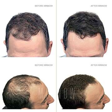 Minnow Best Keratin Hair Building Fibers Instantly Thickens Thin Hair for Men and Women - Natural Ha...