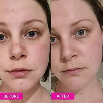 Sand & Sky Australian Glow Berries Intense Glow Moisturizer - Brightening Vitamin C Face Cream | For...