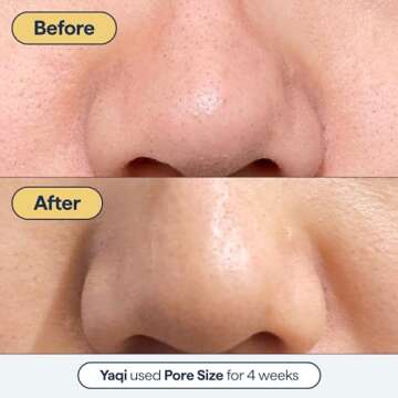 All-in-One Pore Minimizer with Retinol & Salicylic Acid