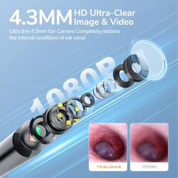 Teslong Digital Otoscope, Ear Camera with Ear Wax Removal Tools, Video Ear Scope Otoscope with Light...