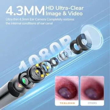 Teslong Digital Otoscope, Ear Camera with Ear Wax Removal Tools, Video Ear Scope Otoscope with Light...