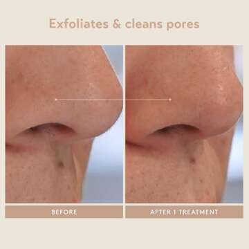 Shani Darden Triple Acid Peel for Radiant Skin Care