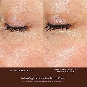 Rejuvenate Your Skin with Summer Fridays Retinol Serum