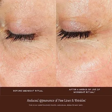 Rejuvenate Your Skin with Summer Fridays Retinol Serum