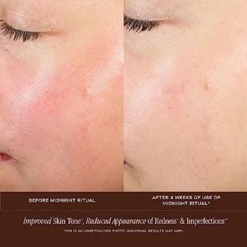 Rejuvenate Your Skin with Summer Fridays Retinol Serum