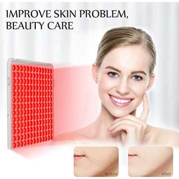 Serfory Red Light Device for Skin and Pain Relief