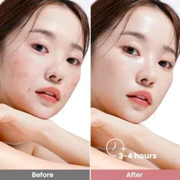 Elvira Bio-Collagen Face Mask - Deep Hydrating Overnight Face Mask, Korean Skincare, Facial Treatments & Masks for Women - Firming and Moisturizing, 4-Pack