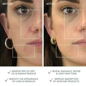 FOREO Luna 3: Anti-Aging Cleansing Brush for Healthy Skin