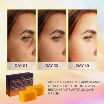 VALITIC Kojic Acid Soap for Hyperpigmentation - with Glutathione, Collagen & Vitamin C - Natural Soap Bars with Turmeric - Original Japanese Complex for Dark Spot Correction - 4 Pack
