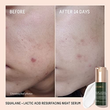 Experience Smooth Skin with BIOSSANCE Lactic Acid Serum