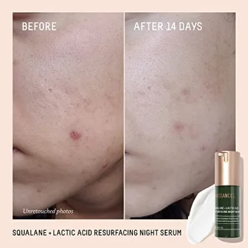 Experience Smooth Skin with BIOSSANCE Lactic Acid Serum