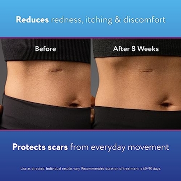 ScarAway Silicone Scar Gel for Face, Body & Acne Treatment