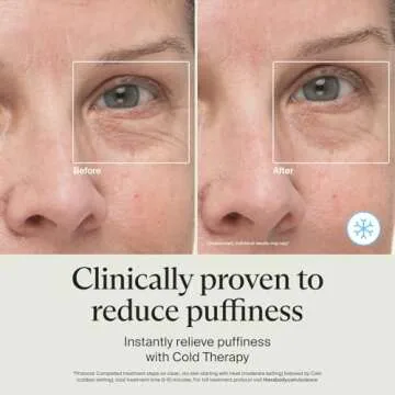 TheraFace Depuffing Wand – Cold and heat skincare treatment to depuff and glow; beauty wand, face roller and eye massager for dark circles and radiant skin, White