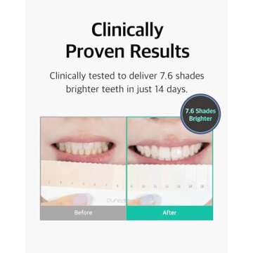 Live Orals Pure Dia Teeth Whitening Gel - Safe at-Home Kit, Hydrogen Peroxide, Mouthpiece. Dentist Formulated for Sensitive Teeth, 28 Treatments