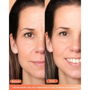 NEWKEY Red Light Therapy Mask for Clear Skin and Anti-Aging