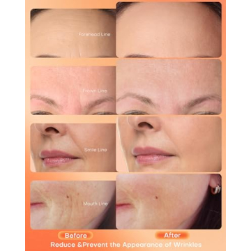 NEWKEY Red Light Therapy Mask for Clear Skin and Anti-Aging