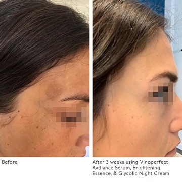 Luxurious Caudalie Holiday Gift Set for Radiance